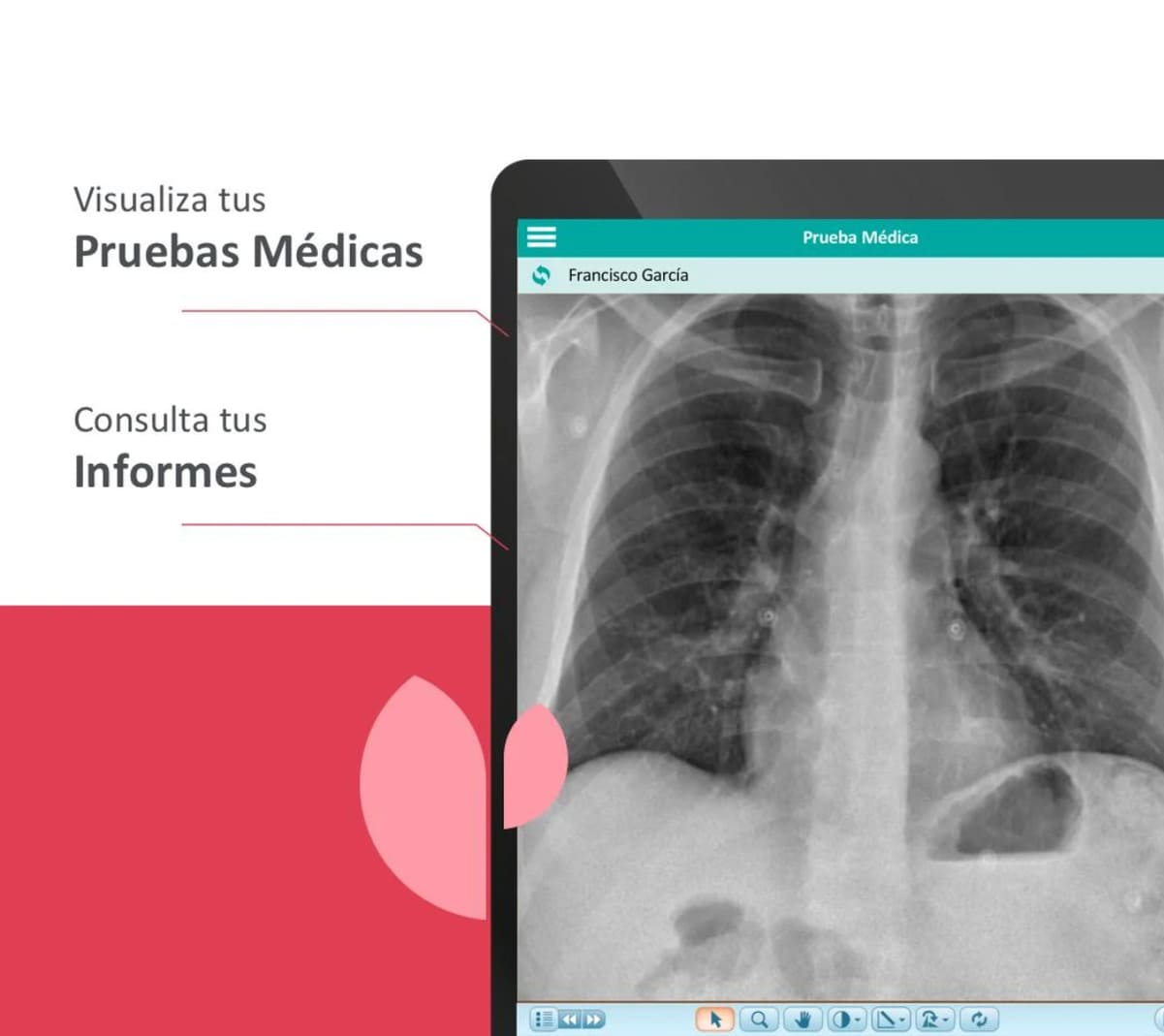 consulta de pruebas médicas en miquironsalud