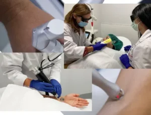 tratamiento láser dermatología