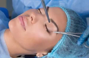 blefaroplastia